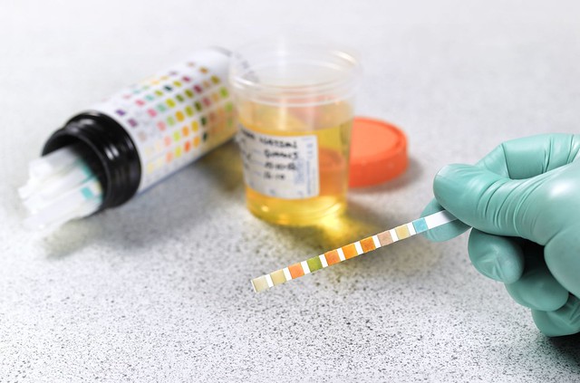 How Long Do Drugs Stay in Your System? how-long-do-drugs-stay-in-your-system
